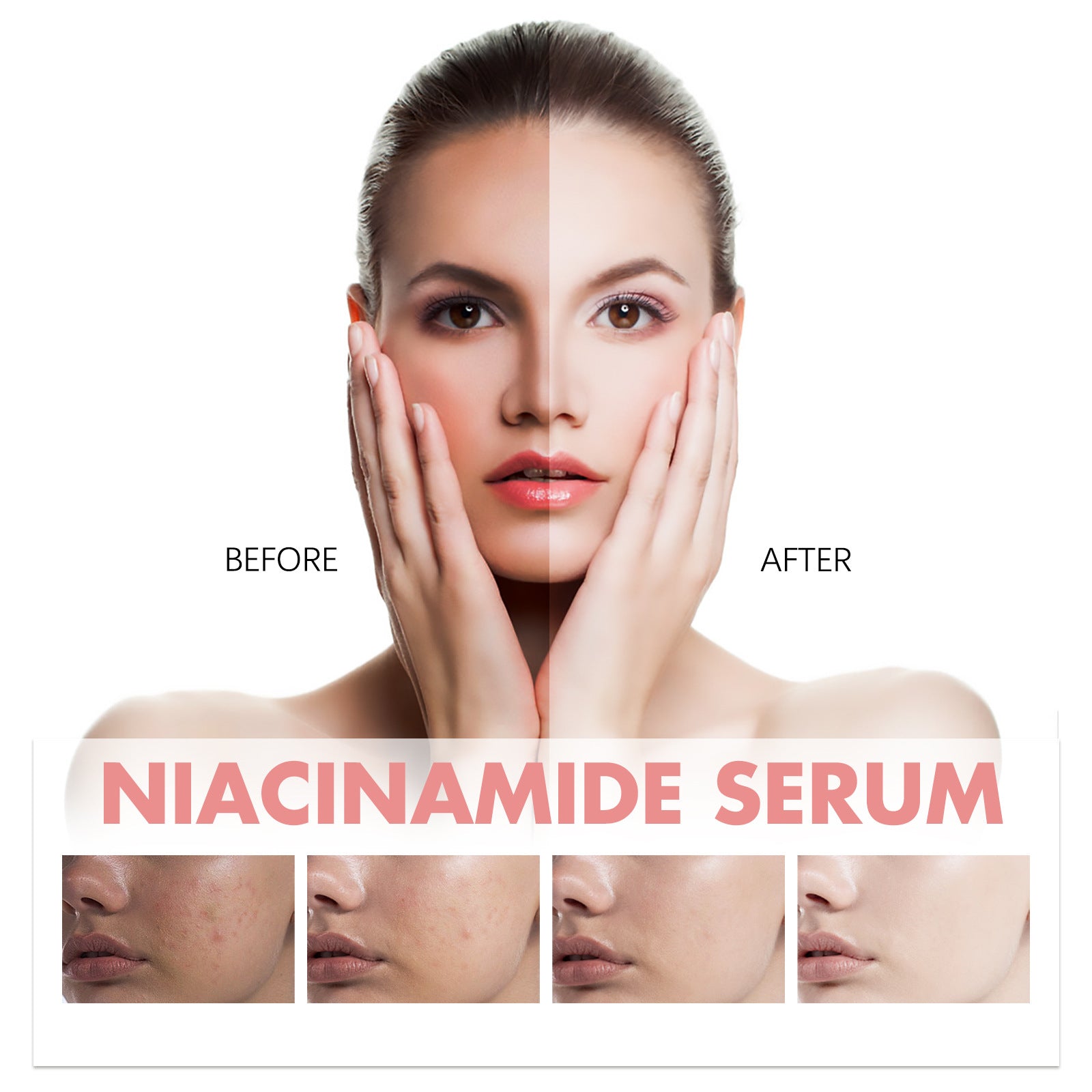 Niacinamide Clinical Grade Brightening Serum-Essence