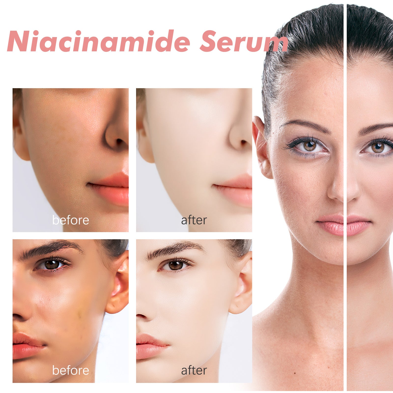 Niacinamide Clinical Grade Brightening Serum-Essence